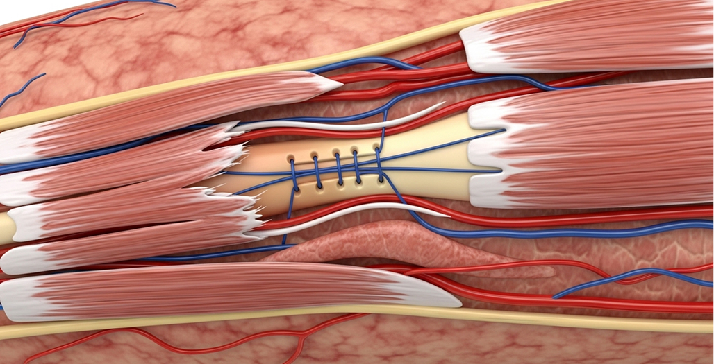 Your Knee's Extensor Mechanism